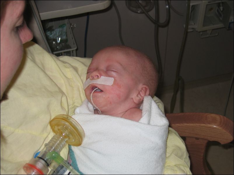 Working to wean Sebastian from CPAP